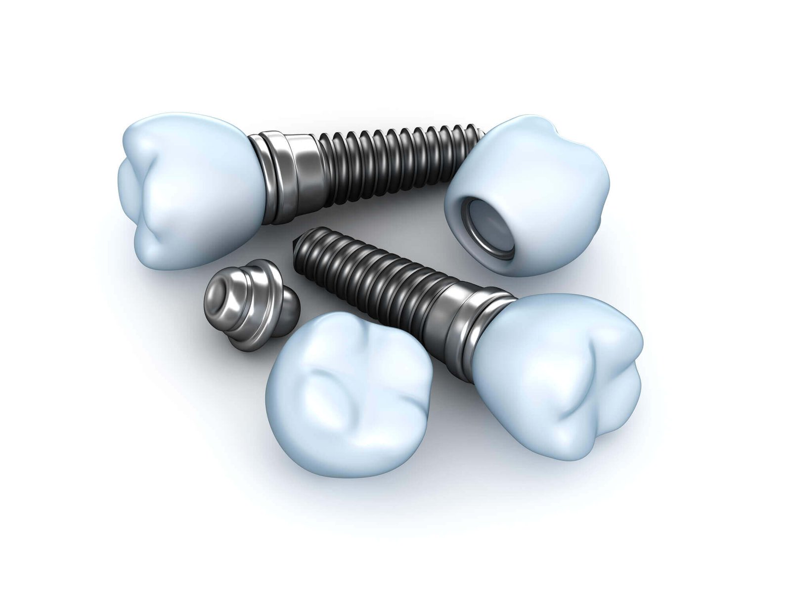 Dental Implants North Miami