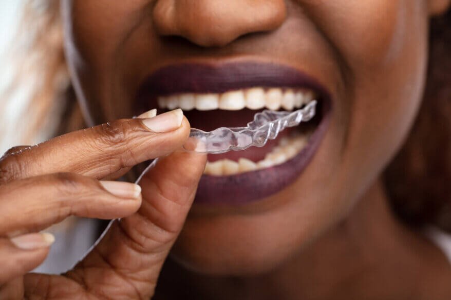 black woman about to wear her Aventura Invisalign®